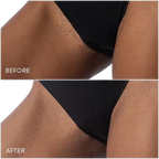 جهاز Femz Pro لإزالة الشعر بتقنية IPL